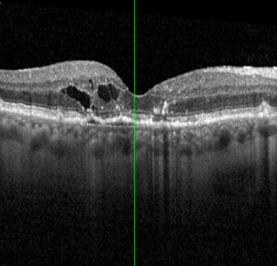Augenklinik Castrop-Rauxel IVOM